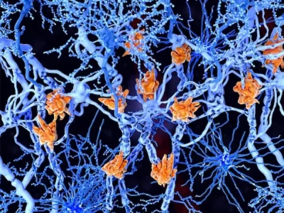 Regenerative Medicine for Multiple Sclerosis